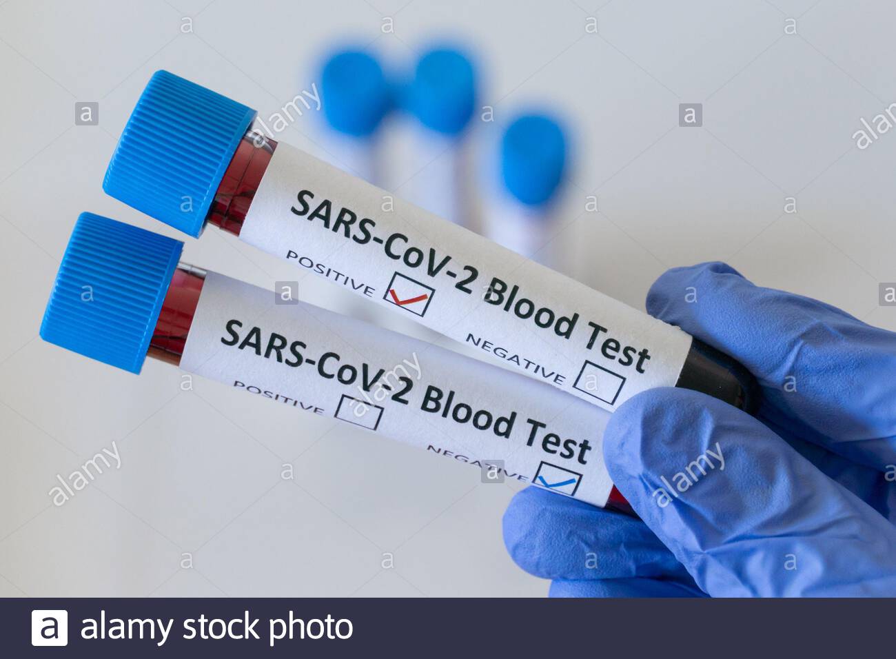 पर्सामा २१ जनाले काेराेना जितेर घर फर्के