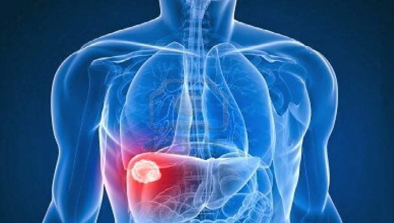 कलेजो कसरी स्वस्थ राख्ने ?