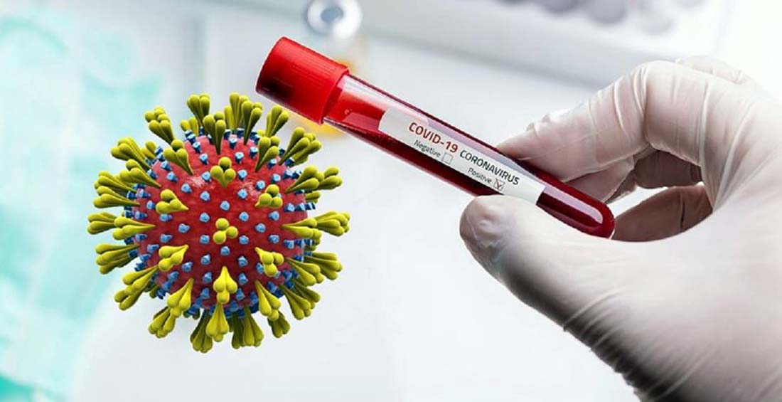 थप ३१२ जनामा कोरोना  पुष्टि,२ जनाको मृत्यु