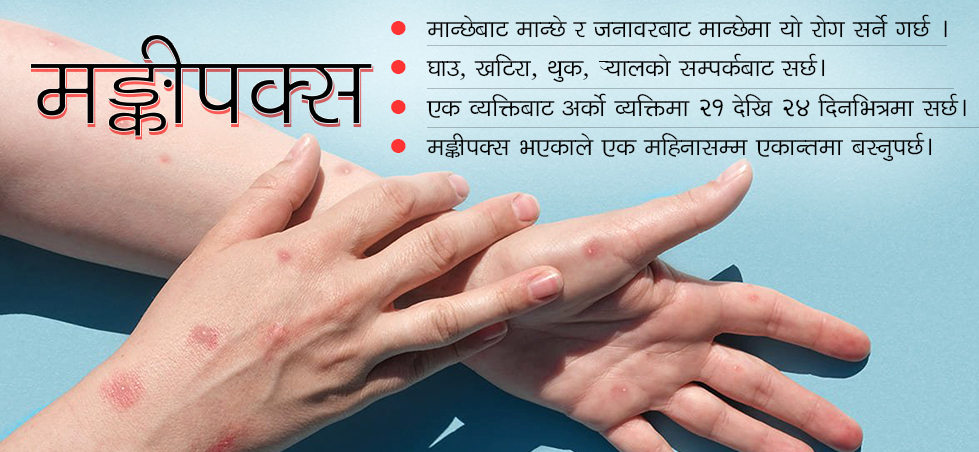 मङ्कीपक्सका २४ हजारभन्दा बढी बिरामी भेटिए,यस्तो छ बच्ने उपाय
